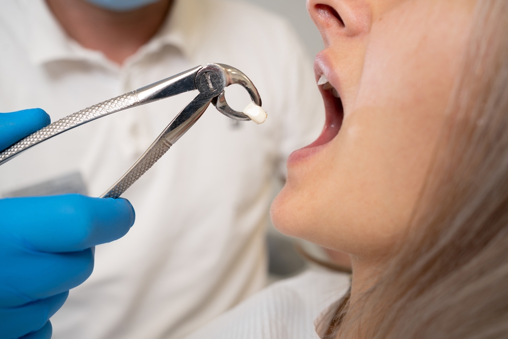 Patient smiling during dental checkup – Ideal Dental Houston TX